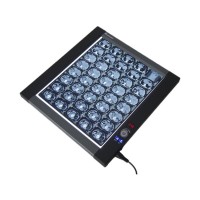 OEM support one bank LED Film viewer for medical