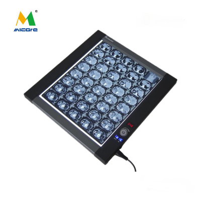 Manufacturer for LED medical x ray film viewer negatoscope