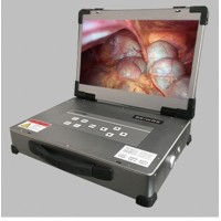 Medical Endoscope Cold Light source & full HD camera endoscope camera module