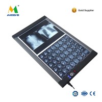 LED double x ray film viewer