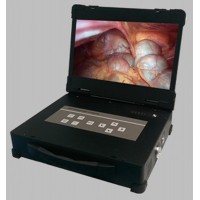 Endoscope & surgical Monitor &LED light sources medical endoscope camera system